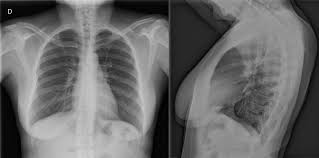 Imagen cardiotorácica. Interpretación de radiografías de tórax